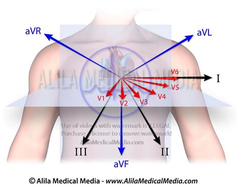 1. The Standard 12 Lead ECG .